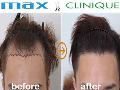 maxclinique.com